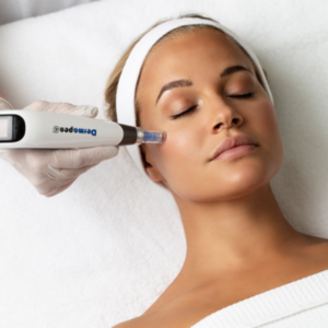Dermapen 4 i motala